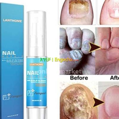 Lanthome nail Repair  የተበላሸ ጥፍርን ወደ ተፈጥሮ ቦታው የሚመልስ  በፈንገስ የተበላሹ ጣጦችን የሚመልስ  ጥፍርን ያማረ የሚያደ